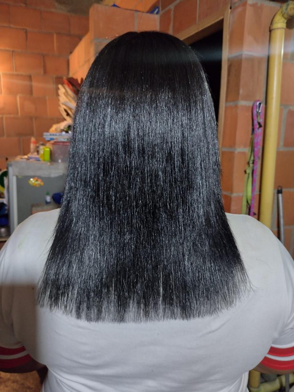 Antes