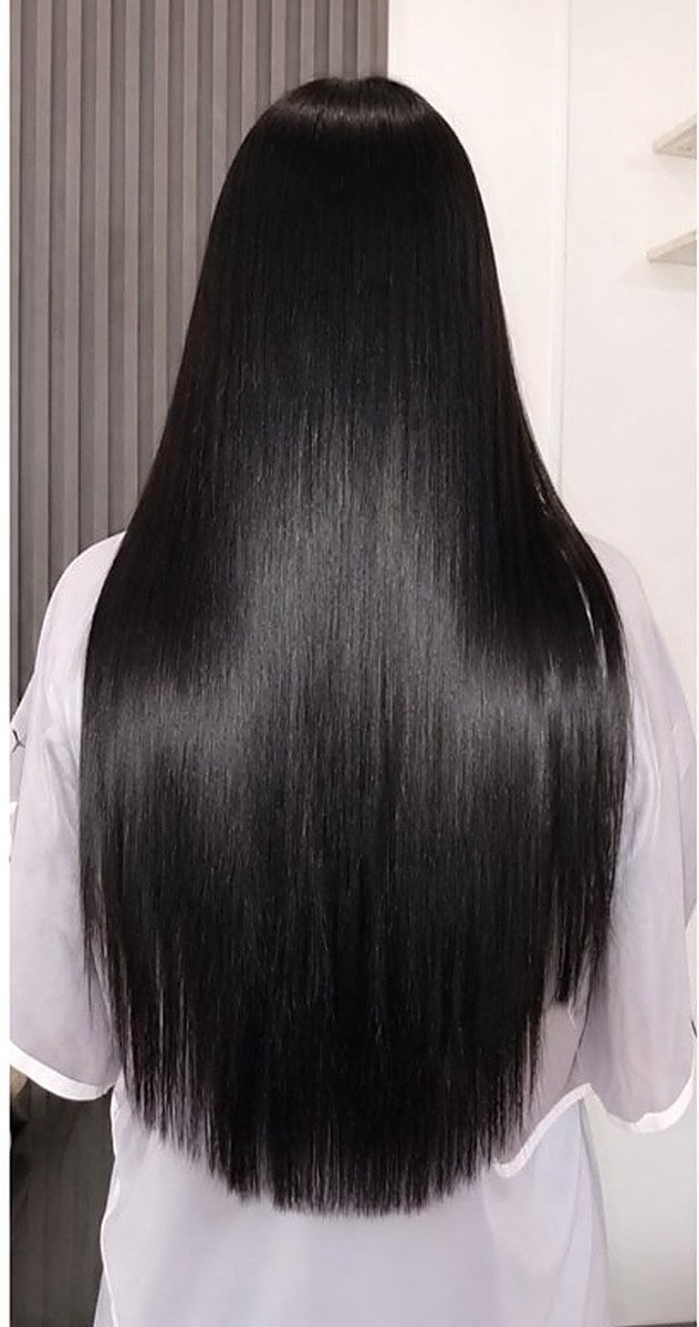 Antes